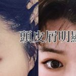 擷取