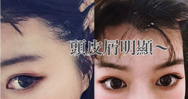 擷取